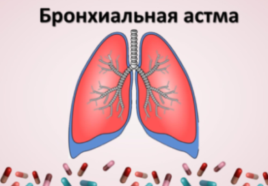 БРОНХИАЛЬНАЯ АСТМА: как снизить риски и взять болезнь под контроль